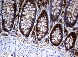 NME1 Monoclonal Antibody (OTI7D6), TrueMAB , OriGene 100 &mu;L; Unconjugated:Antibodies,
