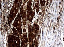 NME1 Monoclonal Antibody (OTI7D6), TrueMAB , OriGene 100 &mu;L; Unconjugated:Antibodies,