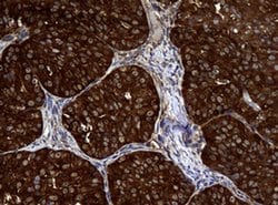 NME1 Monoclonal Antibody (OTI3F2), TrueMAB , OriGene 100 &mu;L; Unconjugated:Antibodies,