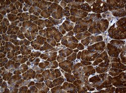 NME1 Monoclonal Antibody (OTI3F2), TrueMAB , OriGene 100 &mu;L; Unconjugated:Antibodies,