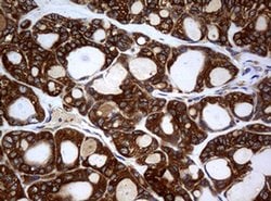 NME1 Monoclonal Antibody (OTI3F2), TrueMAB , OriGene 100 &mu;L; Unconjugated:Antibodies,