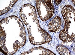 NME1 Monoclonal Antibody (OTI3F2), TrueMAB , OriGene:Antibodies:Primary
