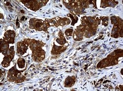 NME1 Monoclonal Antibody (OTI3F2), TrueMAB , OriGene 100 &mu;L; Unconjugated:Antibodies,