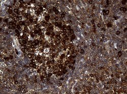 NME1 Monoclonal Antibody (OTI3F2), TrueMAB , OriGene 100 &mu;L; Unconjugated:Antibodies,