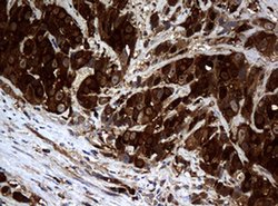 NME1 Monoclonal Antibody (OTI3F2), TrueMAB , OriGene 100 &mu;L; Unconjugated:Antibodies,