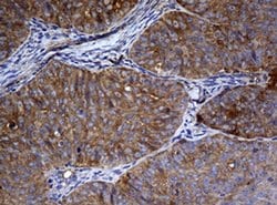 NME1 Monoclonal Antibody (OTI1A12), TrueMAB , OriGene 100 &mu;L; Unconjugated:Antibodies,