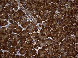 NME1 Monoclonal Antibody (OTI1A12), TrueMAB , OriGene 100 &mu;L; Unconjugated:Antibodies,