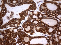 NME1 Monoclonal Antibody (OTI1A12), TrueMAB , OriGene 100 &mu;L; Unconjugated:Antibodies,