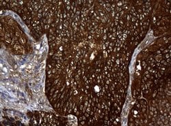 NME1 Monoclonal Antibody (OTI1A12), TrueMAB , OriGene 100 &mu;L; Unconjugated:Antibodies,