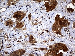 NME1 Monoclonal Antibody (OTI1A12), TrueMAB , OriGene 100 &mu;L; Unconjugated:Antibodies,