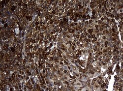 NME1 Monoclonal Antibody (OTI1A12), TrueMAB , OriGene 100 &mu;L; Unconjugated:Antibodies,