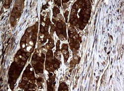 NME1 Monoclonal Antibody (OTI1A12), TrueMAB , OriGene 100 &mu;L; Unconjugated:Antibodies,