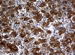 NME1 Monoclonal Antibody (OTI7F6), TrueMAB , OriGene 100 &mu;L | Buy Online | Origene Technologies | Fisher Scientific