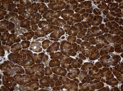 NME1 Monoclonal Antibody (OTI4H2), TrueMAB , OriGene 100 &mu;L; Unconjugated:Antibodies,