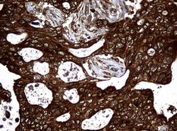 NME1 Monoclonal Antibody (OTI4H2), TrueMAB , OriGene 100 &mu;L; Unconjugated:Antibodies,