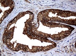 NME1 Monoclonal Antibody (OTI4H2), TrueMAB , OriGene 100 &mu;L; Unconjugated:Antibodies,