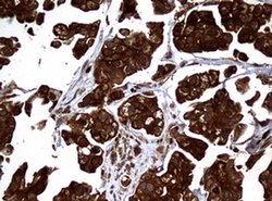 NME1 Monoclonal Antibody (OTI4H2), TrueMAB , OriGene 100 &mu;L; Unconjugated:Antibodies,