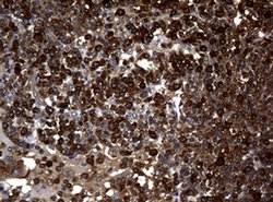 NME1 Monoclonal Antibody (OTI4H2), TrueMAB , OriGene 100 &mu;L; Unconjugated:Antibodies,