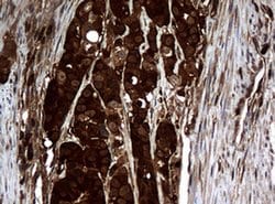 NME1 Monoclonal Antibody (OTI4H2), TrueMAB , OriGene 100 &mu;L; Unconjugated:Antibodies,