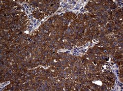 NME1 Monoclonal Antibody (OTI6A11), TrueMAB , OriGene 100 &mu;L; Unconjugated:Antibodies,