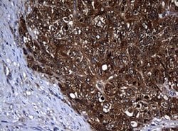 NME1 Monoclonal Antibody (OTI6A11), TrueMAB , OriGene 100 &mu;L; Unconjugated:Antibodies,