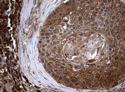 NME1 Monoclonal Antibody (OTI22F10), TrueMAB , OriGene 100 &mu;L; Unconjugated:Antibodies,