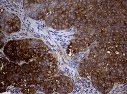 NME1 Monoclonal Antibody (OTI22F10), TrueMAB , OriGene 100 &mu;L; Unconjugated:Antibodies,
