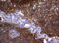 NME1 Monoclonal Antibody (OTI22F10), TrueMAB , OriGene 100 &mu;L; Unconjugated:Antibodies,