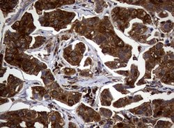 NME1 Monoclonal Antibody (OTI22F10), TrueMAB , OriGene 100 &mu;L; Unconjugated:Antibodies,