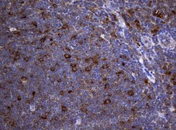 NME1 Monoclonal Antibody (OTI22F10), TrueMAB , OriGene 100 &mu;L; Unconjugated:Antibodies,