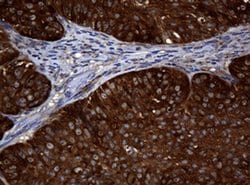 NME1 Monoclonal Antibody (OTI2H10), TrueMAB , OriGene 100 &mu;L; Unconjugated:Antibodies,