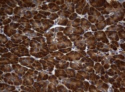 NME1 Monoclonal Antibody (OTI2H10), TrueMAB , OriGene 100 &mu;L; Unconjugated:Antibodies,
