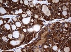 NME1 Monoclonal Antibody (OTI2H10), TrueMAB , OriGene 100 &mu;L; Unconjugated:Antibodies,