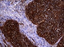 NME1 Monoclonal Antibody (OTI2H10), TrueMAB , OriGene 100 &mu;L; Unconjugated:Antibodies,