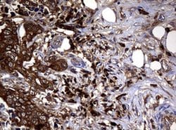 NME1 Monoclonal Antibody (OTI2H10), TrueMAB , OriGene 100 &mu;L; Unconjugated:Antibodies,