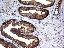 NME1 Monoclonal Antibody (OTI2H10), TrueMAB , OriGene 100 &mu;L; Unconjugated:Antibodies,
