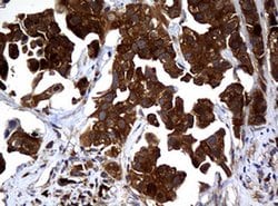 NME1 Monoclonal Antibody (OTI2H10), TrueMAB , OriGene 100 &mu;L; Unconjugated:Antibodies,
