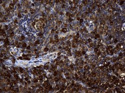 NME1 Monoclonal Antibody (OTI2H10), TrueMAB , OriGene 100 &mu;L; Unconjugated:Antibodies,