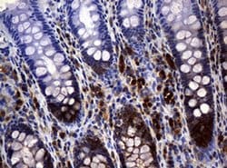 NME1 Monoclonal Antibody (OTI2H10), TrueMAB , OriGene 100 &mu;L; Unconjugated:Antibodies,