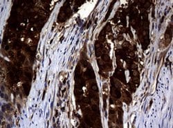 NME1 Monoclonal Antibody (OTI2H10), TrueMAB , OriGene 100 &mu;L; Unconjugated:Antibodies,