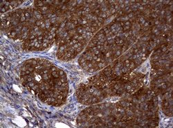 NME1 Monoclonal Antibody (OTI1C11), TrueMAB , OriGene 100 &mu;L; Unconjugated:Antibodies,