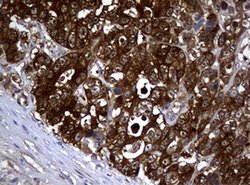 NME1 Monoclonal Antibody (OTI1C11), TrueMAB , OriGene 100 &mu;L; Unconjugated:Antibodies,