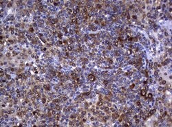 NME1 Monoclonal Antibody (OTI7F4), TrueMAB , OriGene 100 &mu;L | Buy Online | Origene Technologies | Fisher Scientific