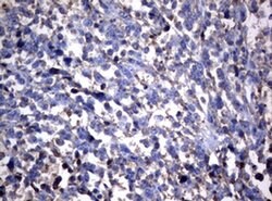 NME1 Monoclonal Antibody (OTI25D8), TrueMAB , OriGene:Antibodies:Primary