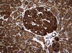 NME1 Mouse anti-Canine, Human, Rat, Clone: UMAB91, liquid, UltraMAB 100