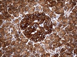 NME1 Mouse anti-Canine, Human, Rat, Clone: UMAB94, liquid, UltraMAB 100