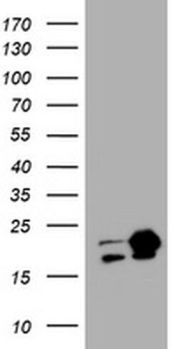 NME1 Monoclonal Antibody (OTI4H2), TrueMAB , OriGene 100 &mu;L; Unconjugated:Antibodies,