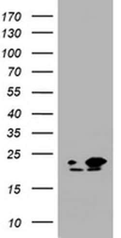 NME1 Monoclonal Antibody (OTI7A1), TrueMAB , OriGene 30 &mu;L; Unconjugated:Antibodies,
