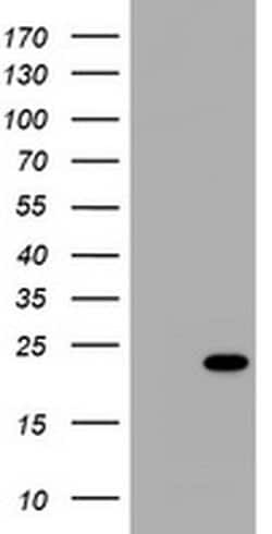 NME1 Monoclonal Antibody (OTI4F11), TrueMAB , OriGene 30 &mu;L; Unconjugated:Antibodies,