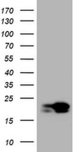 NME1 Monoclonal Antibody (OTI1C11), TrueMAB , OriGene 100 &mu;L; Unconjugated:Antibodies,